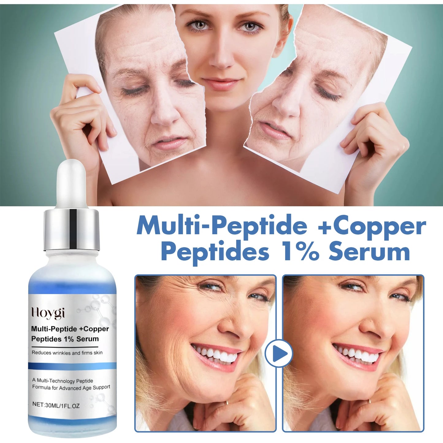 Hoygi Copper Peptide Serum for Wrinkle Reduction and Pore Shrink