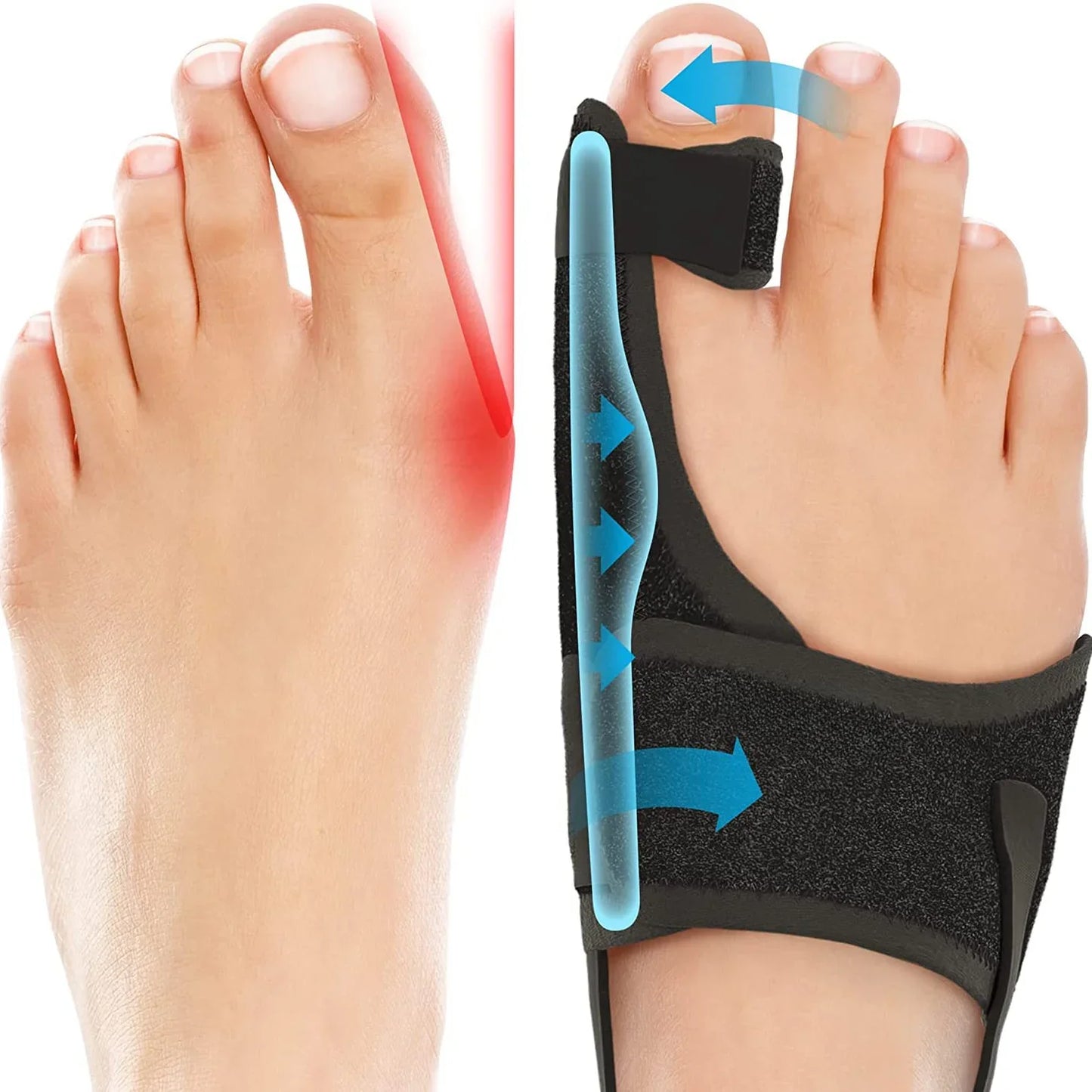 Orthopedic Bunion Splint Corrector Big Toe Separator Pain Relief