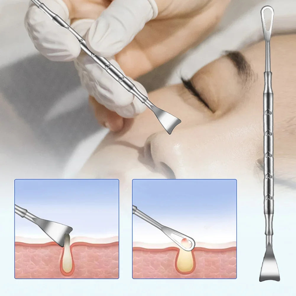 Double Head Stainless Steel Blackhead Remover Blemish Extractor Tool