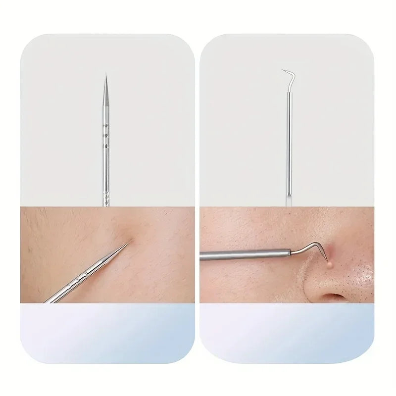 Stainless Steel Skin Care Tool Set Blackhead Pimple Removal 4 7 8 Pieces