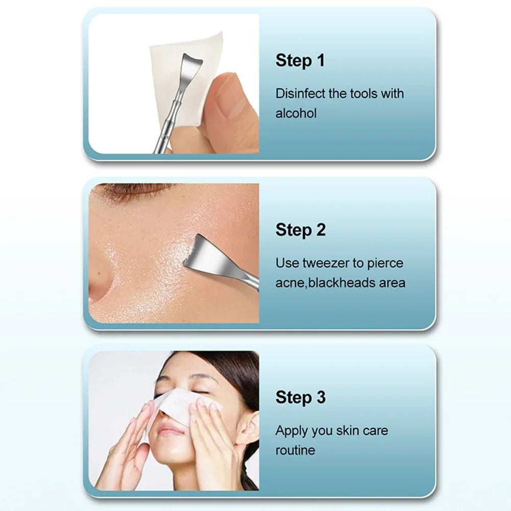 Double Head Stainless Steel Blackhead Remover Blemish Extractor Tool