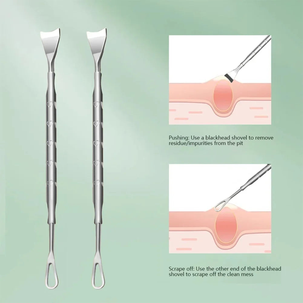 Double Head Stainless Steel Blackhead Remover Blemish Extractor Tool