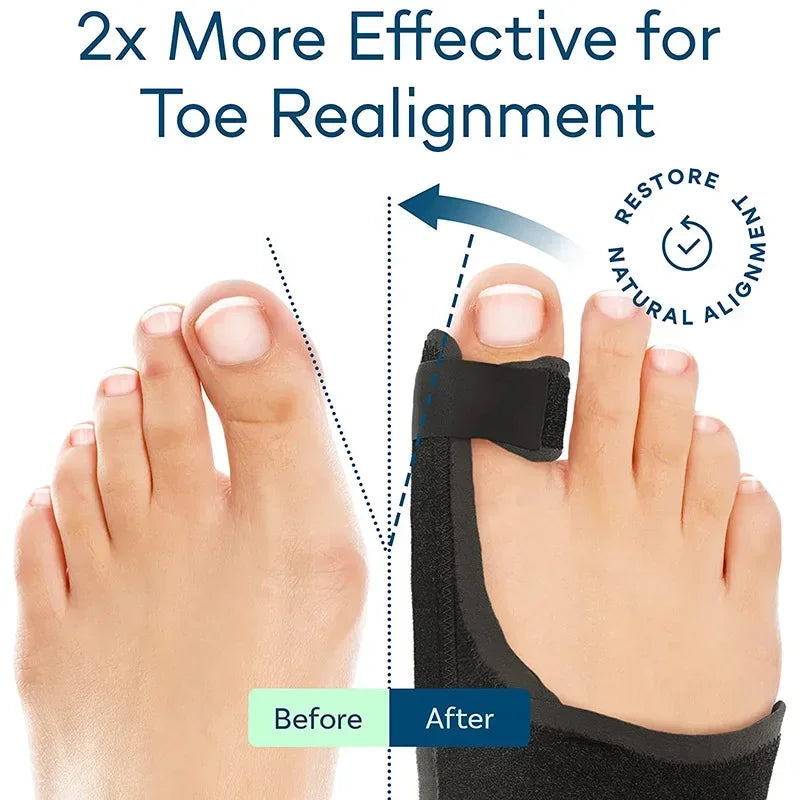 Orthopedic Bunion Splint Corrector Big Toe Separator Pain Relief