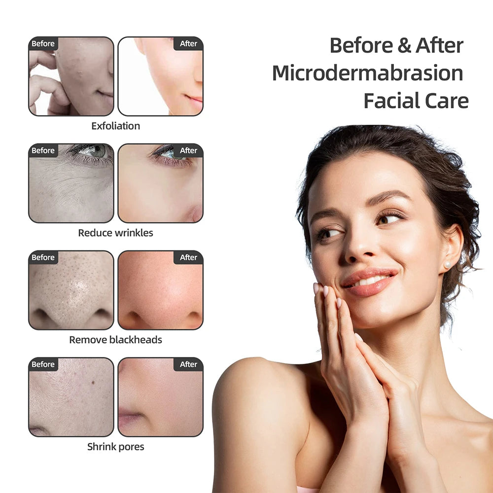 Foreverlily Diamond Microdermabrasion Machine Water Spray Exfoliation