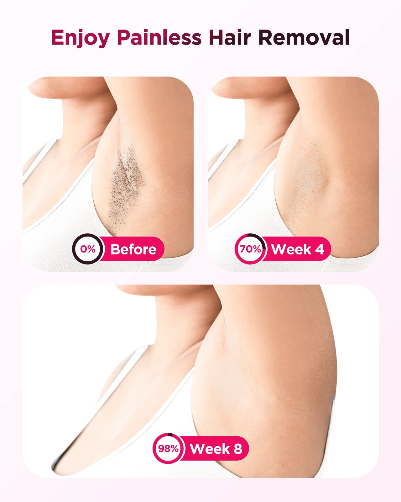 Totmizby IPL Laser Epilator Hair Removal Body Bikini Face